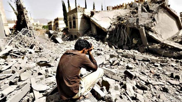 Yemen'in drtte  acil insani yardma muhta