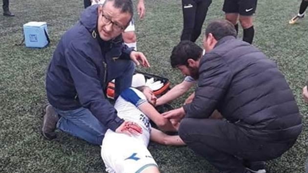 Amatr kme oyuncusu lmden dnd