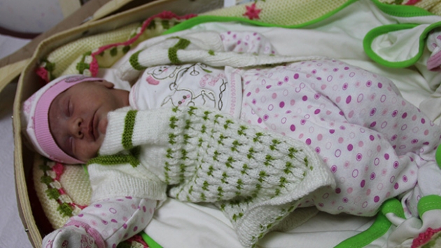 Yalova'da ift dilli olarak dnyaya gelen bebek ameliyatla normale dndrld
