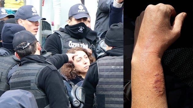  zinsiz yry srasnda kadn polisin kolunu sran HDP'li vekil Aydeniz hakknda soruturma balatld