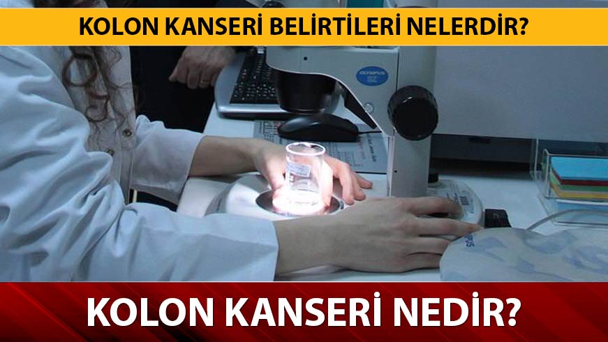 Kolon Kanseri belirtileri nelerdir? Kolan kanseri nedir? 