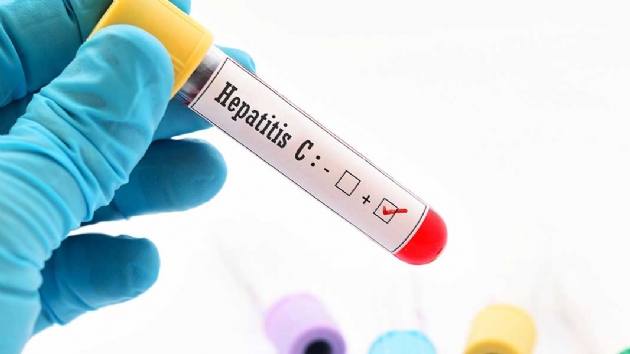 in'de hastanede 69 hastaya yanl uygulamalardan hepatit C bulat