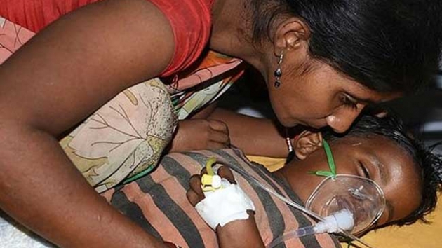 Hindistan'da beyin iltihab salgn: 114 ocuk yaamn yitirdi
