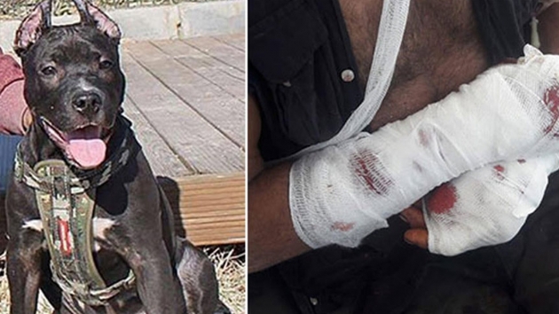 Pitbull sahibine saldrd, polis vurarak kurtard