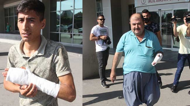 Adana'da 79 acemi kasap kendini kesti
