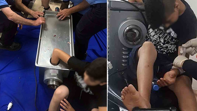 14 yandaki ocuk kolunu kyma makinesine kaptrd