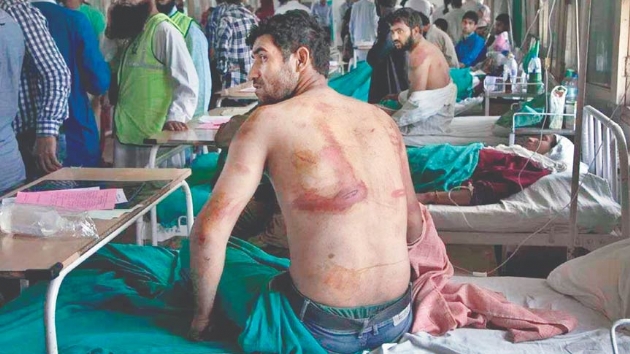 Cammu Kemirde Hint ikencesi