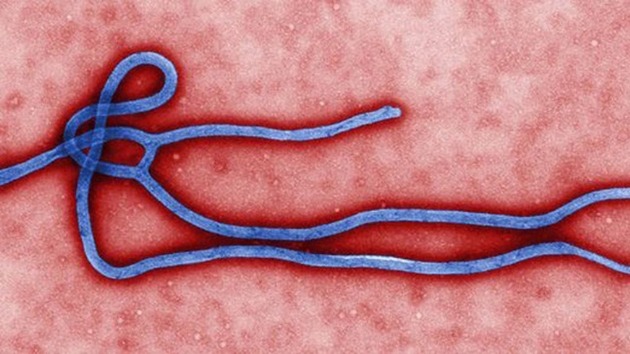 Kongo Demokratik Cumhuriyeti'nde ''Ebola''dan lmler sryor