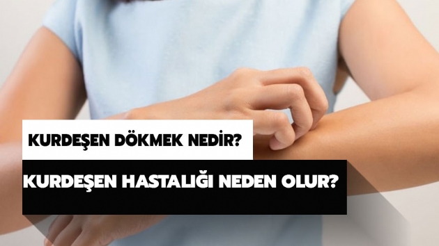 Kurdeen ne demek? Kurdeen dkmek nedir? Kurdeen hastal neden olur?