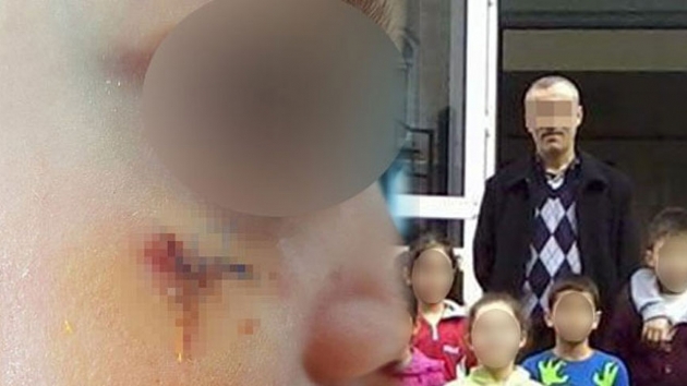 Esenler'de rencisini kitapla yaralayan retmene 4 yl 2 ay hapis cezas verildi