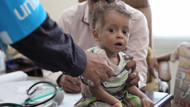 UNICEF: Yemen'de 12 milyon ocuk acil yardma muhta