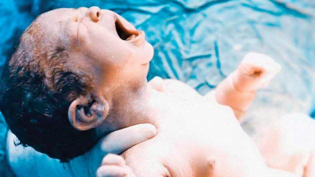 'Doum arlar ilaszazaltlabilir'