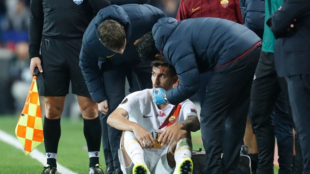 Skandal direkten dnd!