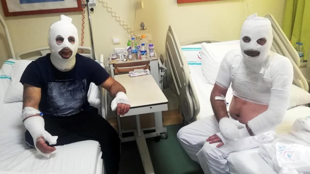 Tinerle temizlik yaparken sigara iin akmak kullannca yandlar