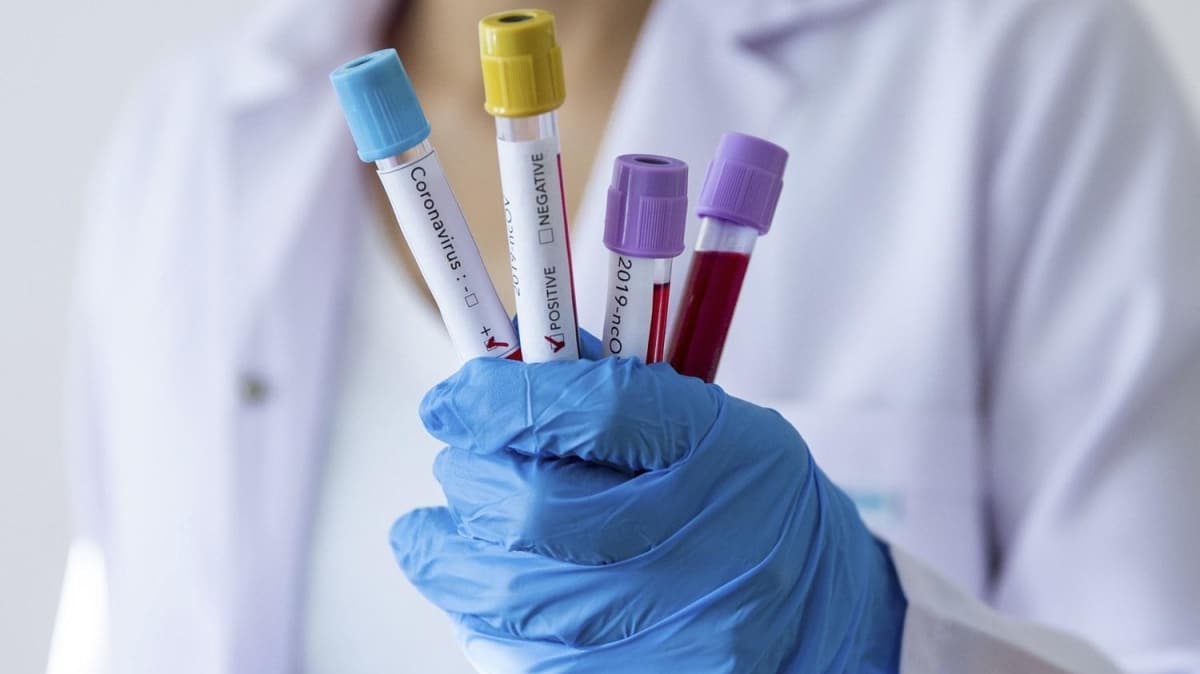 Nijerya ve Yeni Zelanda'da ilk koronavirs vakalar tespit edildi