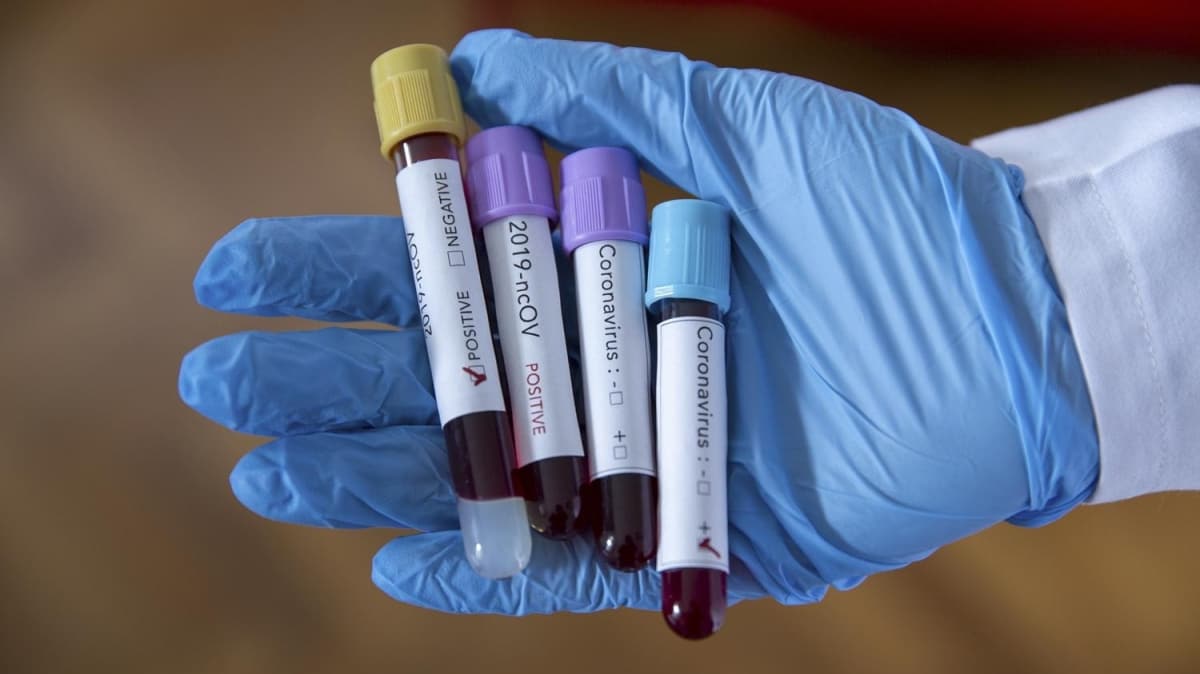 Katar'da ilk kez yeni tip koronavirs vakas grld 
