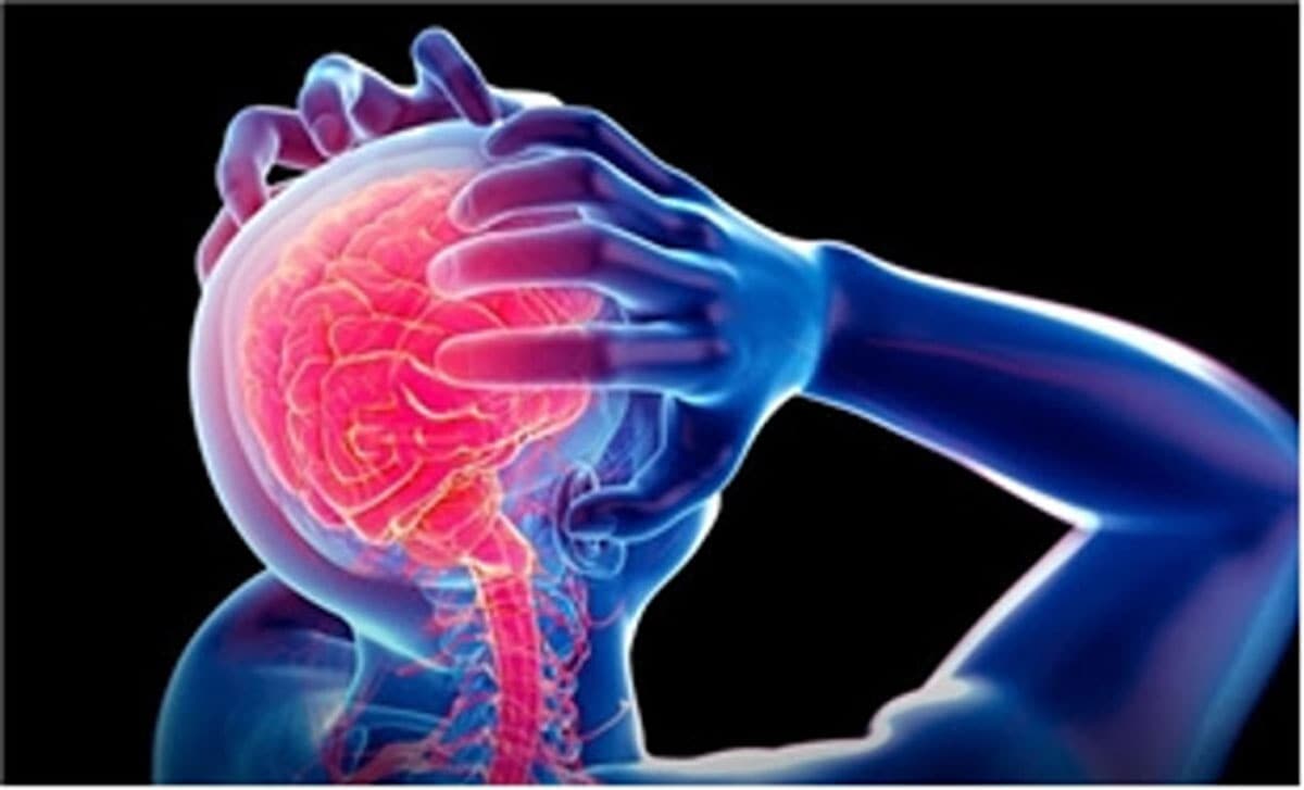 Lodos beyin kanamas�n� tetikler mi?