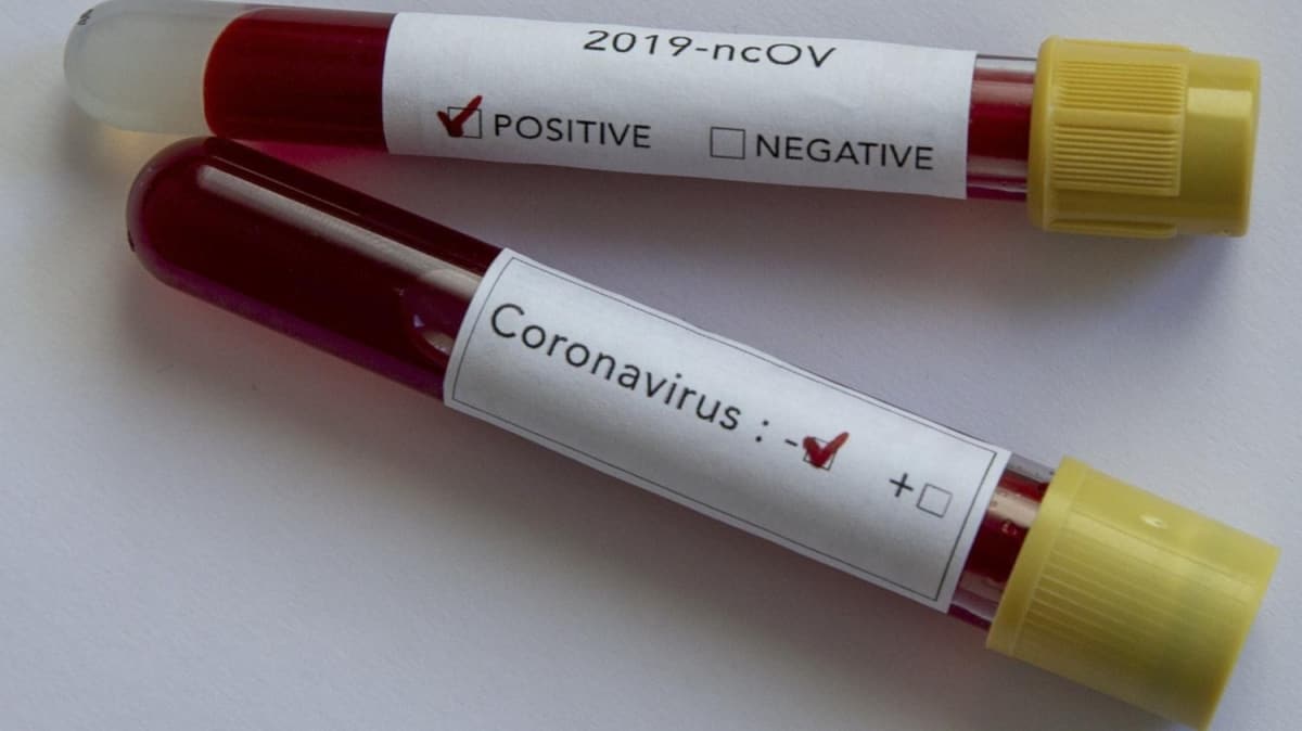 Yeni tip koronavirs Avrupa lkelerinde yaylmaya devam ediyor
