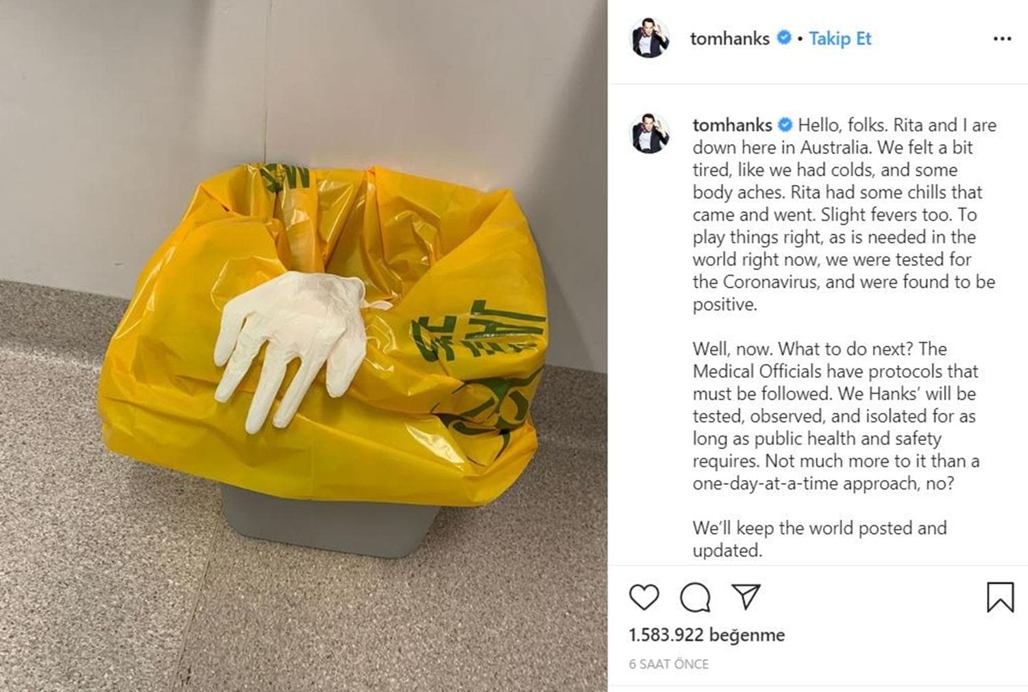 Tom Hanks ve e�ine koronavir�s te�hisi konuldu