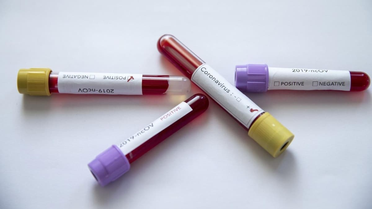 Yunanistan'da koronavirsten ilk lm