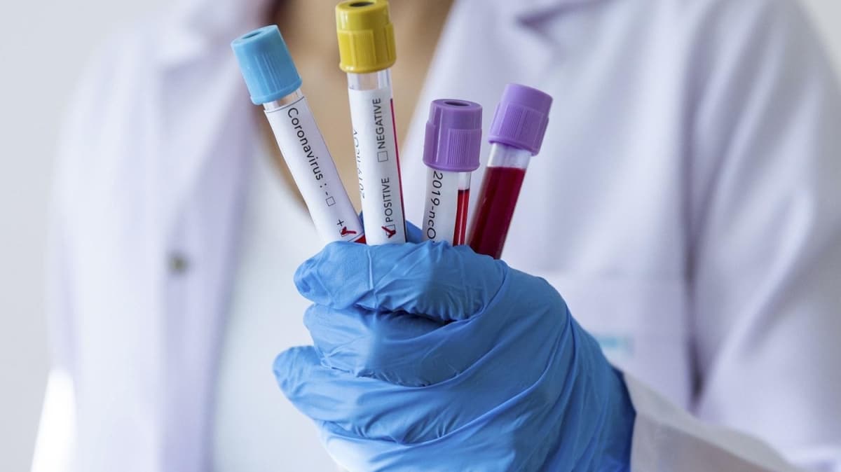 Gabon'da ilk koronavirs vakas grld