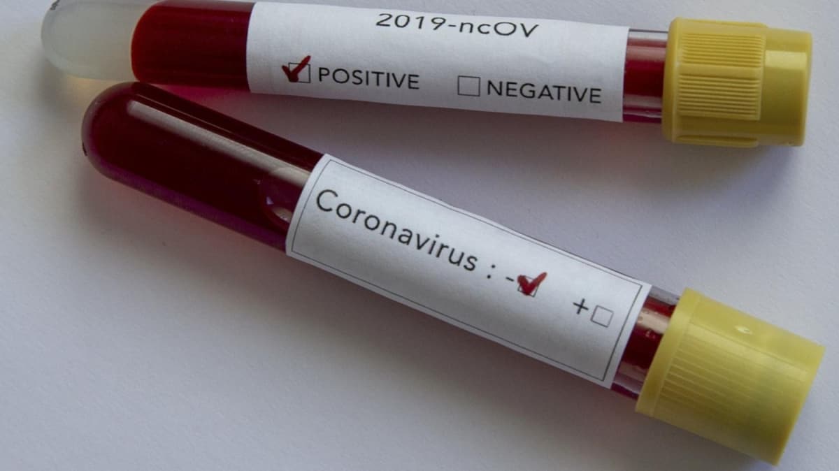 Papua Yeni Gine'de lk yeni tip koronavirs vakas tespit edildi
