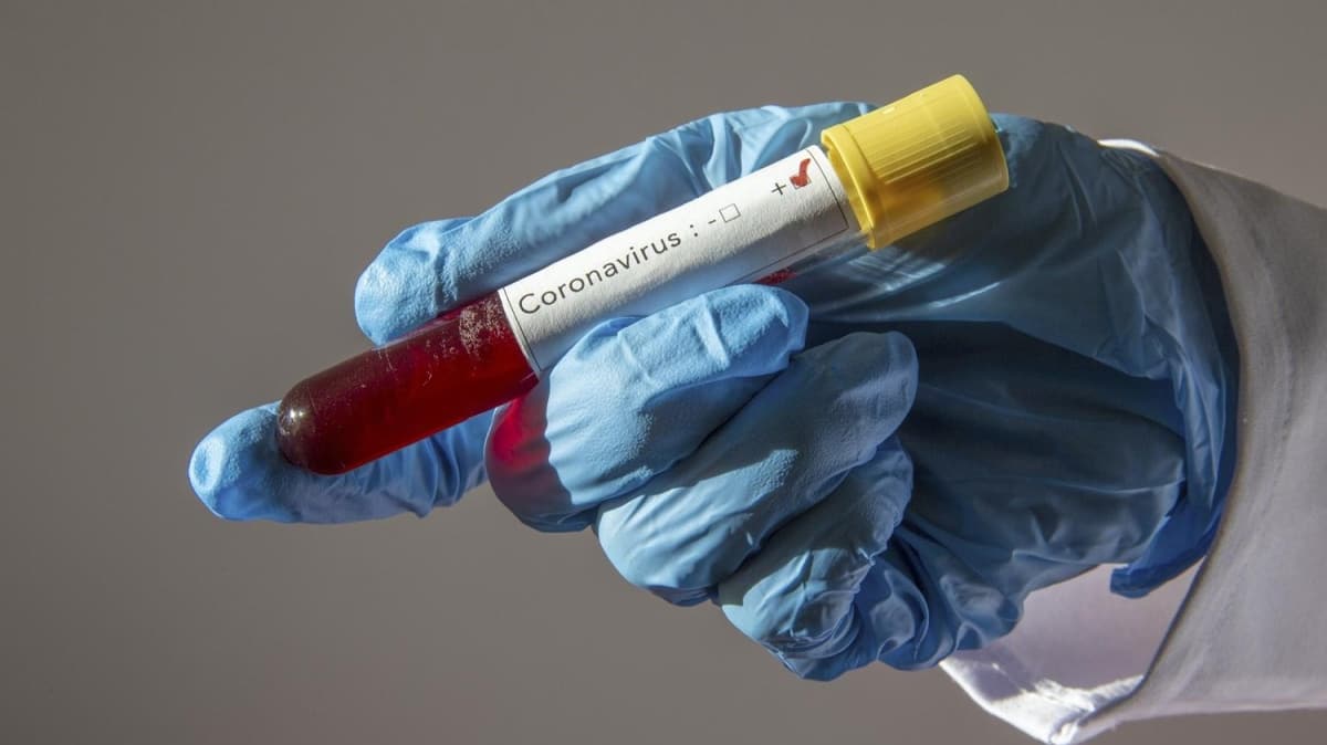 Bilim insanlar duyurdu: 70 tane belirlendi, koronavirse kar test edilecek