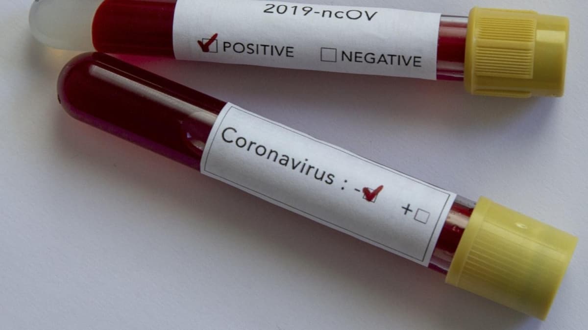 Dnyada koronavirs nedeniyle 16 bin 500' akn kii hayatn kaybetti