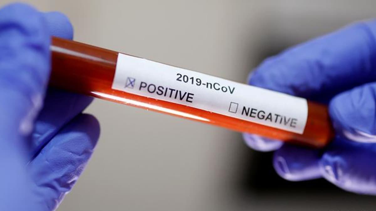 Trkiye'den kritik koronavirs hamlesi: Evde test uygulamas masada