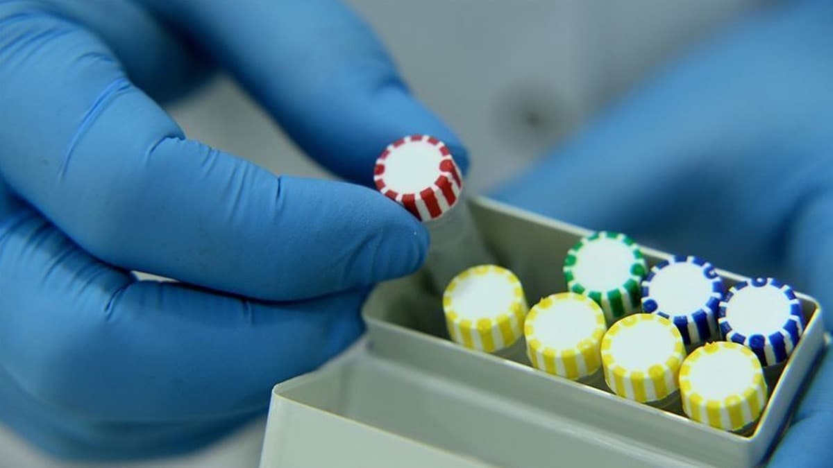 Arap lkelerinde koronavirs kaynakl lmler ve vaka says artyor