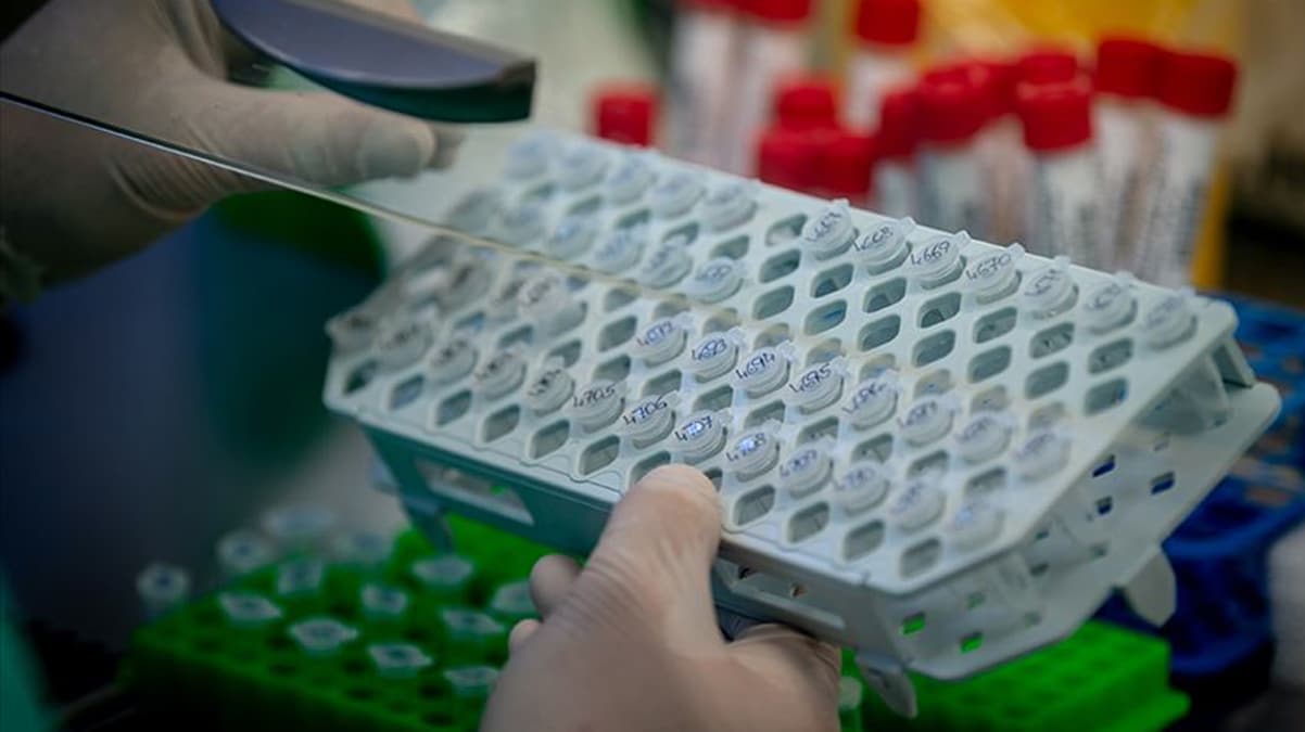 2 dakikada sonu� veriyor