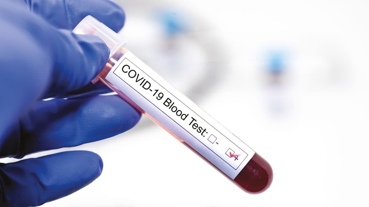 Koronavirs tahlil bilgilerini gizleyen iki laboratuvara soruturma