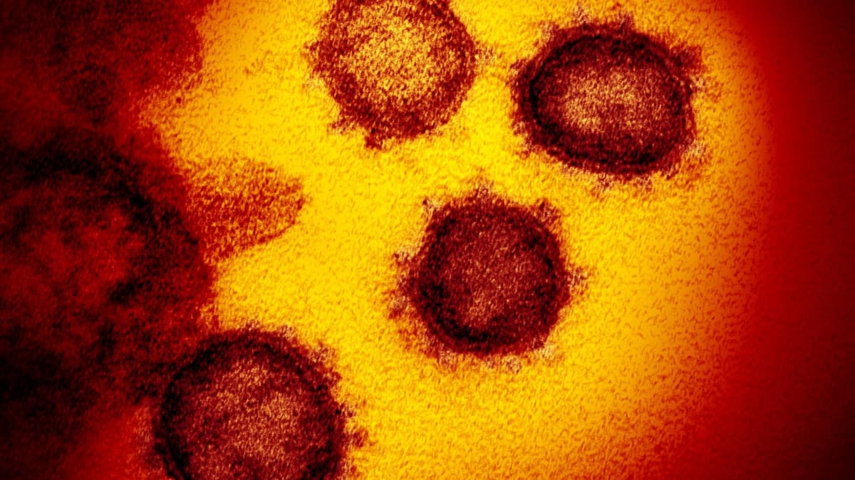 Malatya'da koronavirs tedbirleri: 3 kii yan yana dolaamayacak