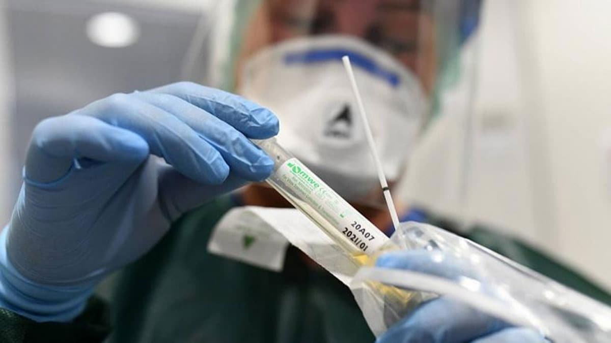 Prof. Dr. Nihat Dilsiz: Kan svsndan elde edilen hcre paracklar ile virsn oalmas nlenebilir