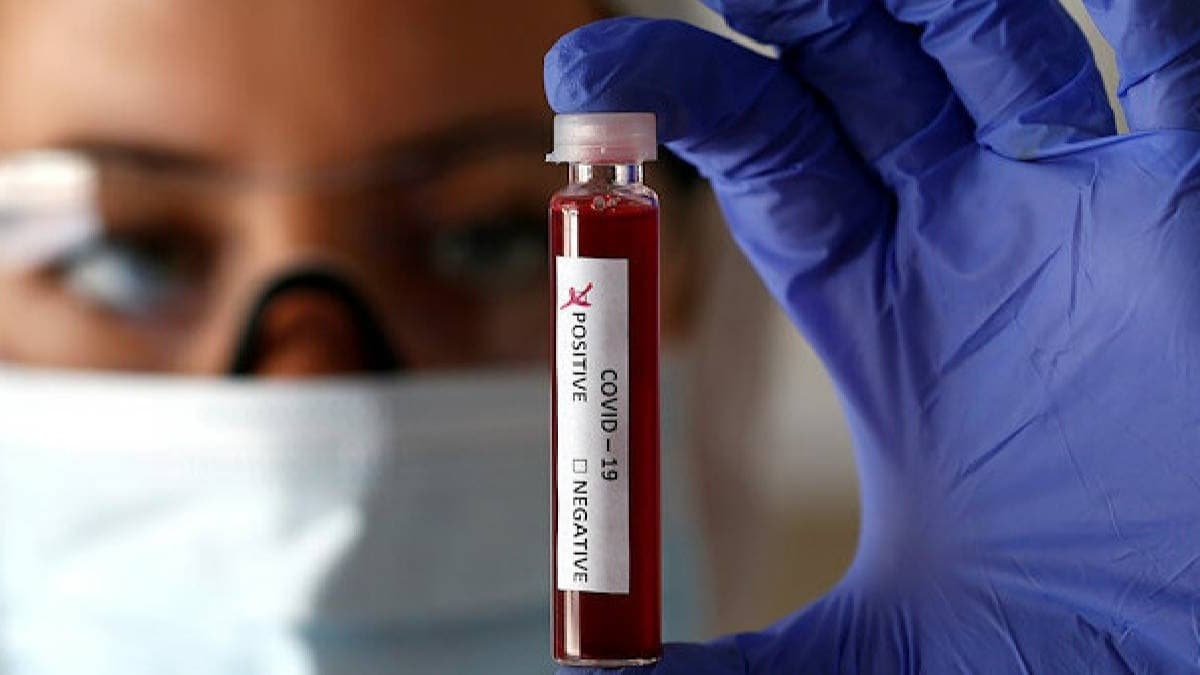 ABD'den koronavirs kan testine onay: Hastal atlatp yeniden virs kapan hastalarn tehisinde etkili