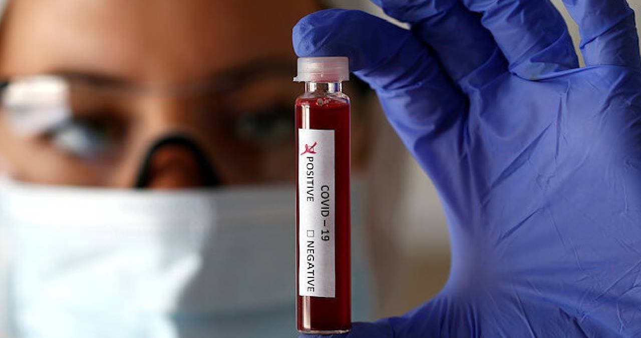 ABD'den koronavir�s kan testine onay