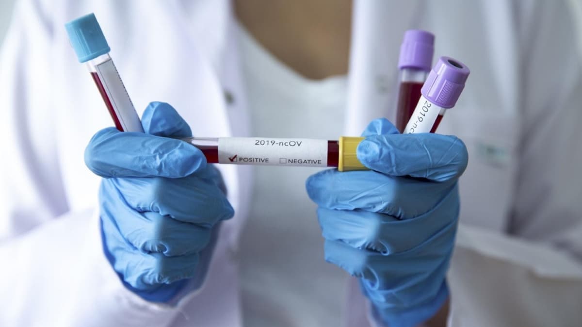 Trkiye'den koronavirs tedavisinde nemli hamle: Gelecek hafta balayacak