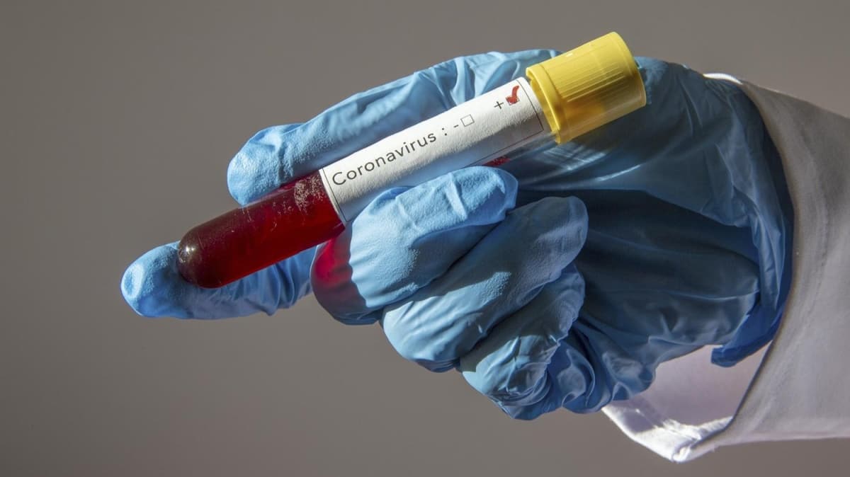 Azerbaycan'da koronavirs vaka says 584'e ykseldi