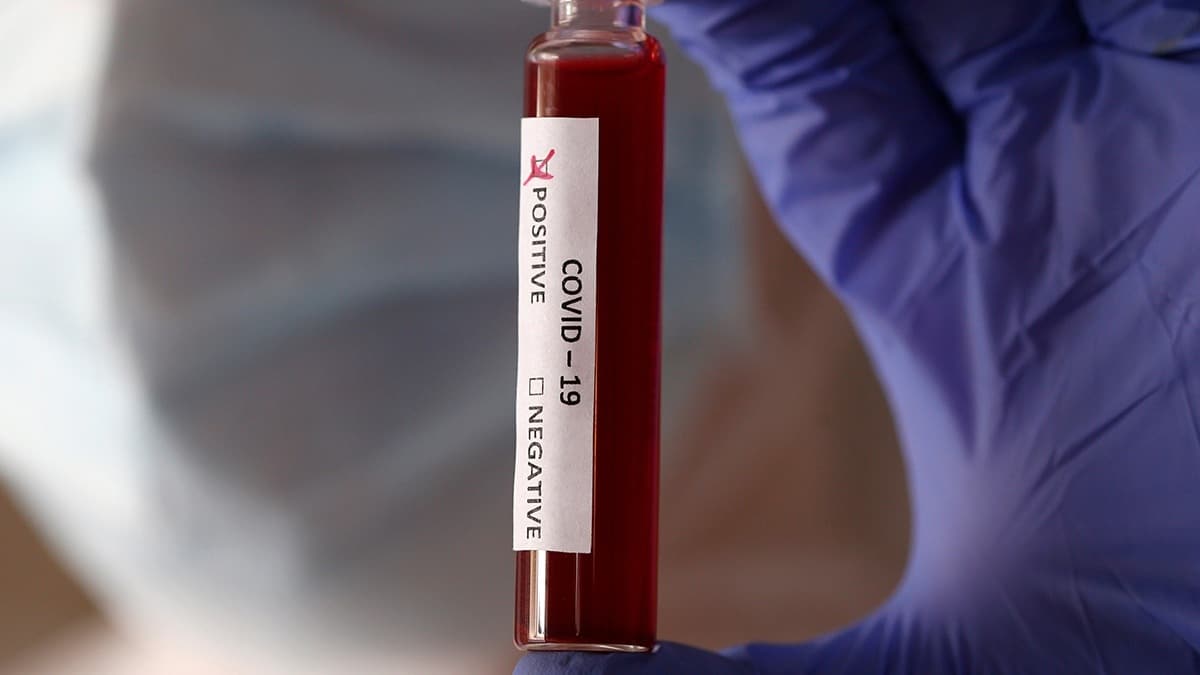 Rusya resmen duyurdu: Hastalarn zerinde denemeye baladk