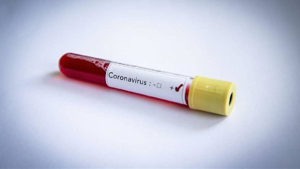 Japonya'da yeni koronavirs lmleri: 119'a ykseldi