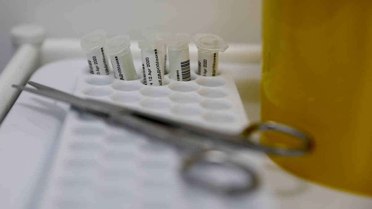 ABD'de yeni koronavirs testine FDA'dan onay