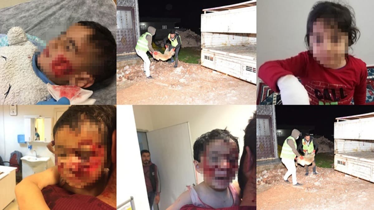Korkun olay! Kpekler ocuklara saldrd 3'nn durumu ar 