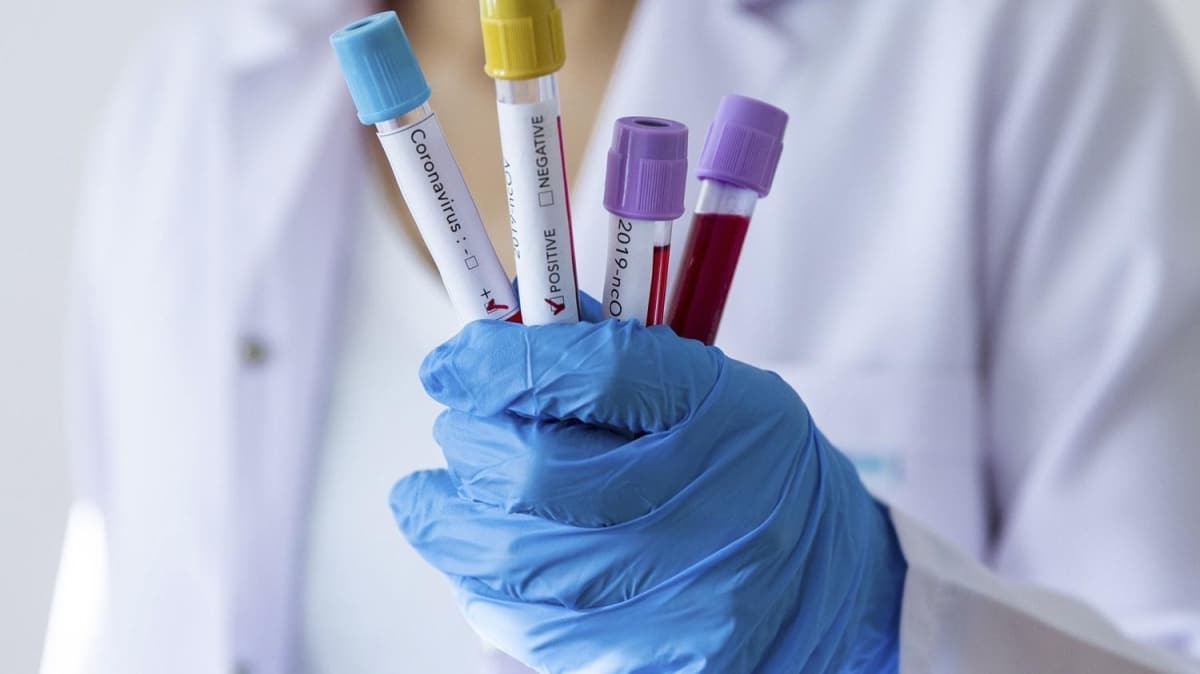 Rusya'da 1 milyon 400 binden fazla koronavirs testi yapld