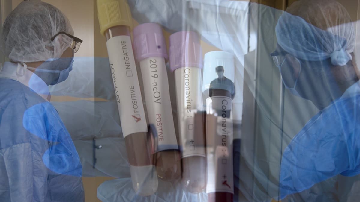 Koronavirse yakalanan tm vatandalarn tedavileri cretsiz yaplacak