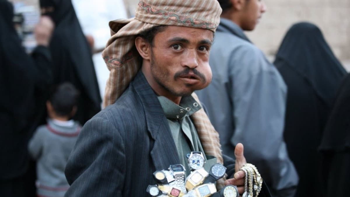 Yemen'in Marib ilinde gat satlan arlar kapatld