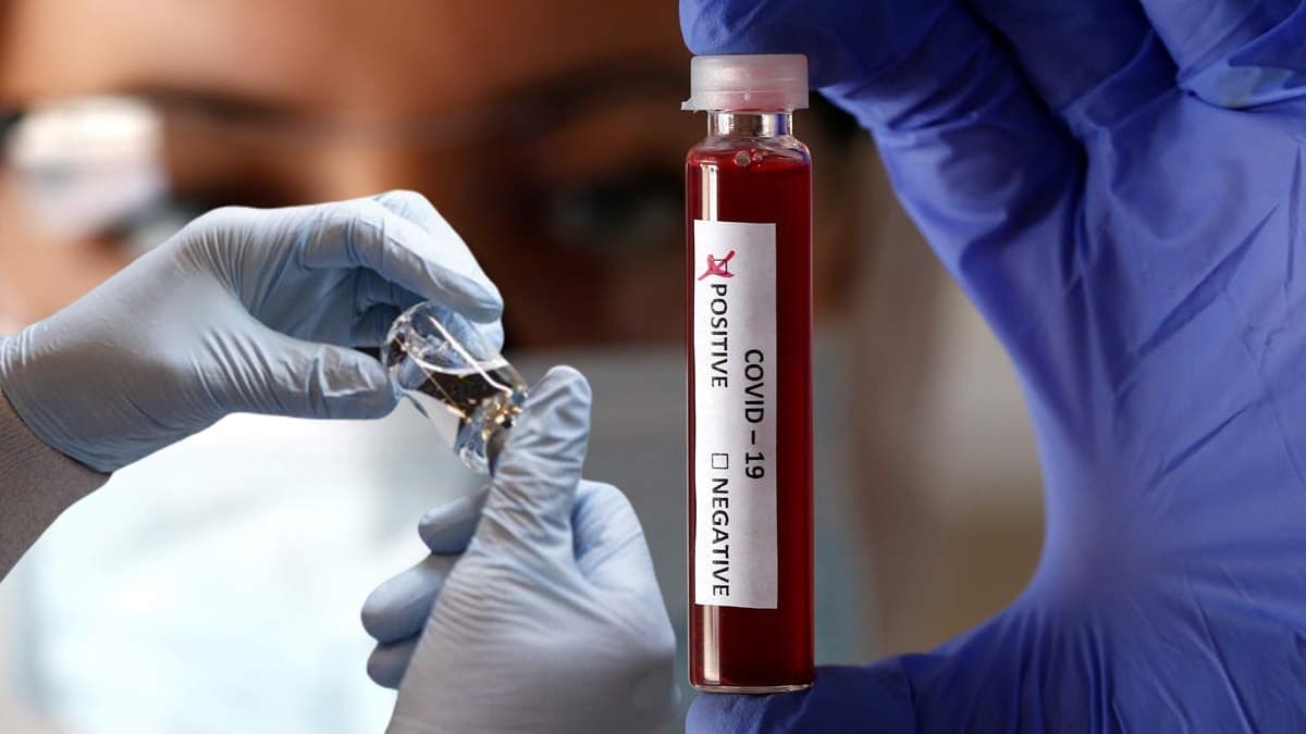 Dnyann konutuu ila: 1 haftada iyiletim