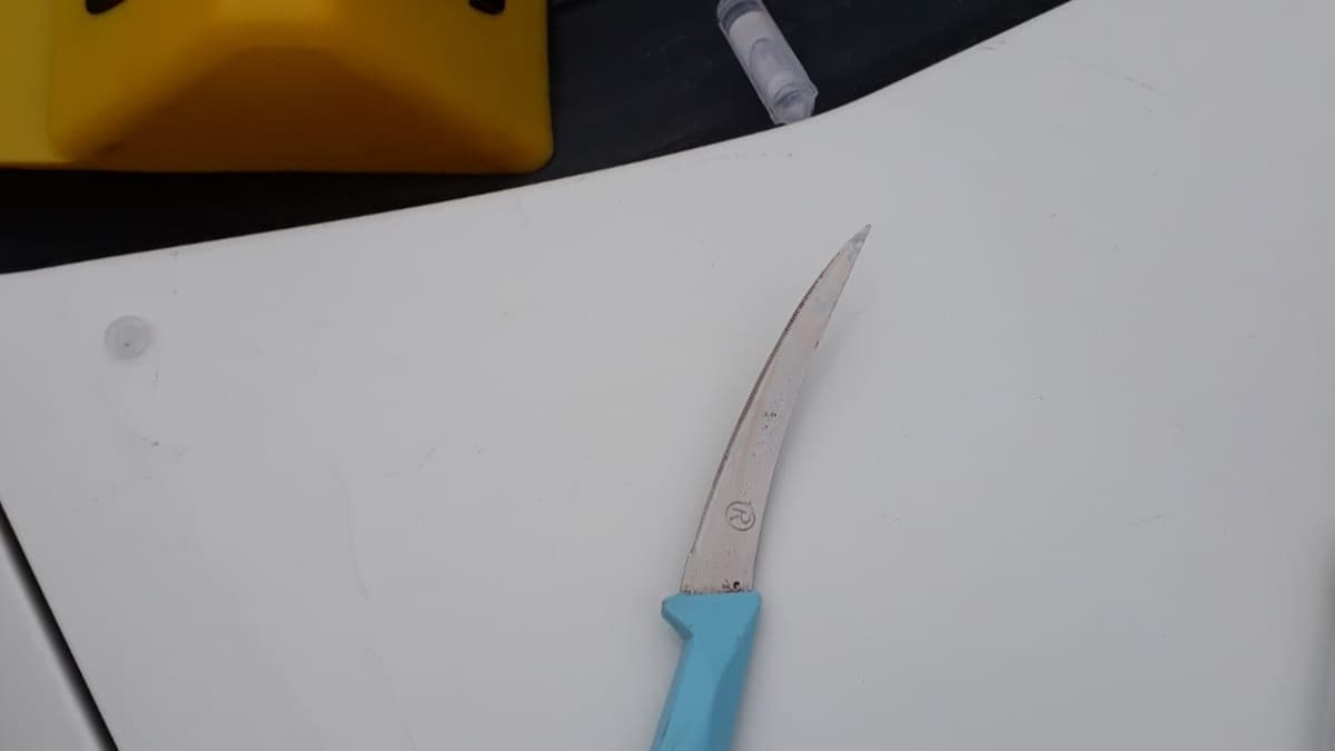 Psikolojik rahatszlklar bulunan bir kadn baka bir kadn ldrd 