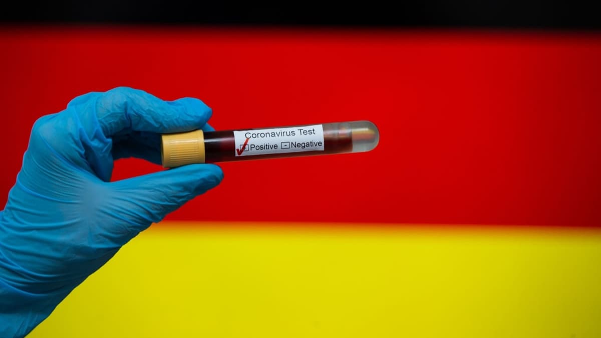 Almanya'da Kovid-19 kaynakl can kayb 5 bin 315'e ykseldi  