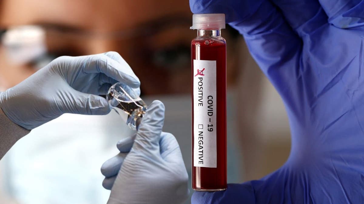 Ev ortam� karantinaya uygun olmayanlar i�in harekete ge�ildi