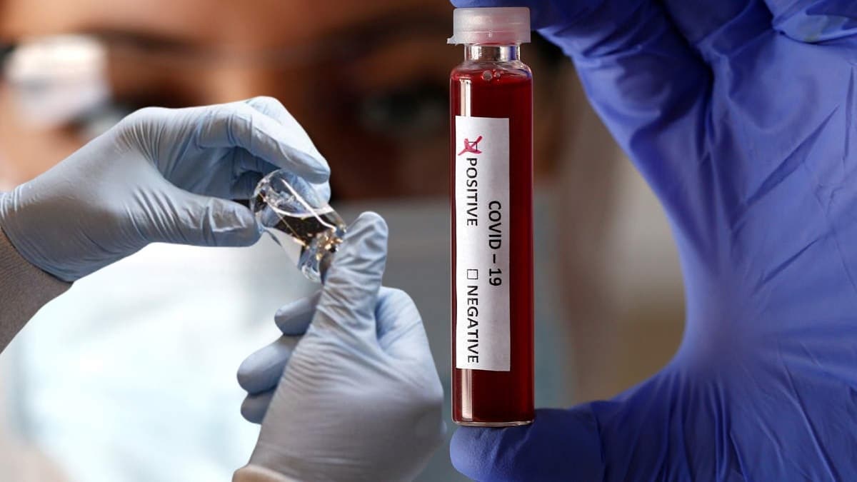 Trkiye iin ok nemli koronavirs uyars: Zincir krlyor biraz daha sabredelim